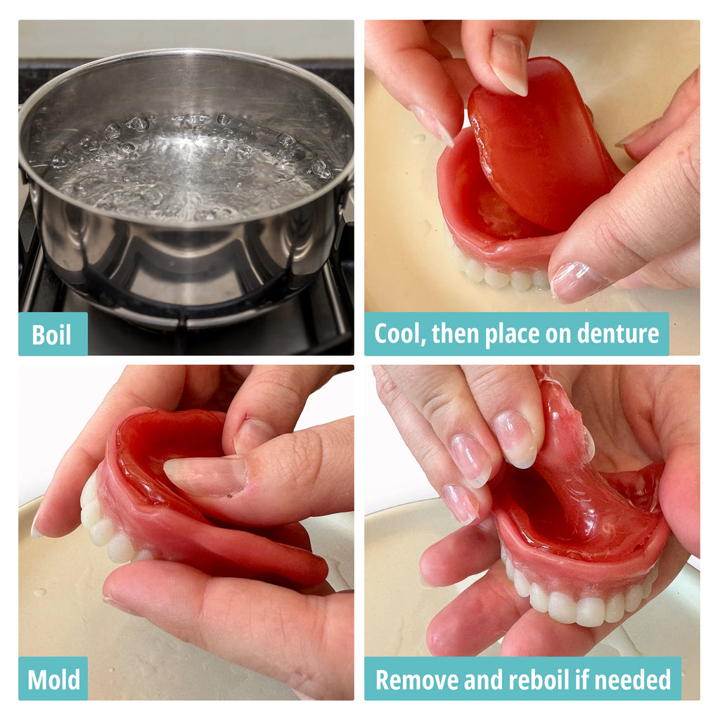 Quick Reline™ - Soft Reline, (Boil & Fit) Full or Partial Denture Reliner Kit